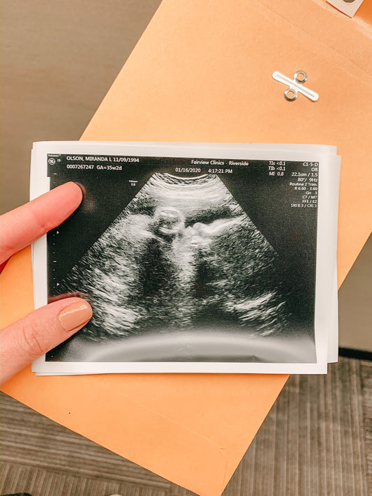 The Second Trimester